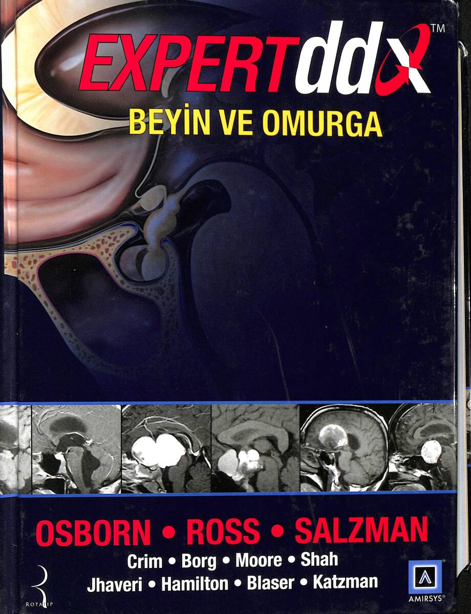 Beyin Ve Omurga / Expert ddx / Osborn - Ross - Salzman NDR89298 - 1